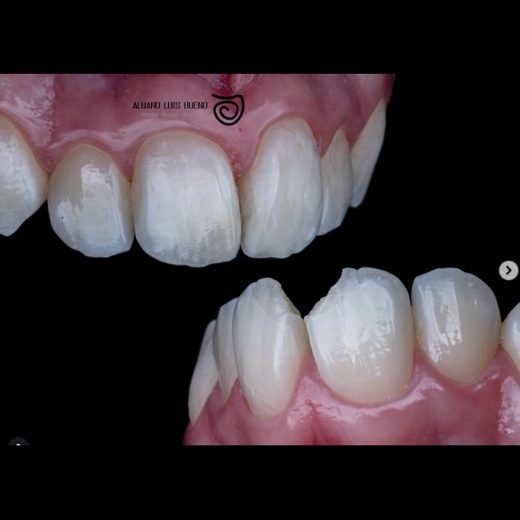 Antes e depois