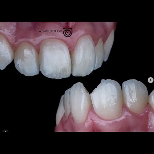 Antes e depois